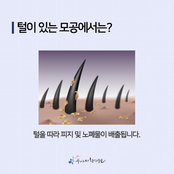 1624076080_gEuO4ctl.jpg