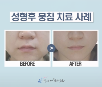 1770628023_NHoURi1A.png