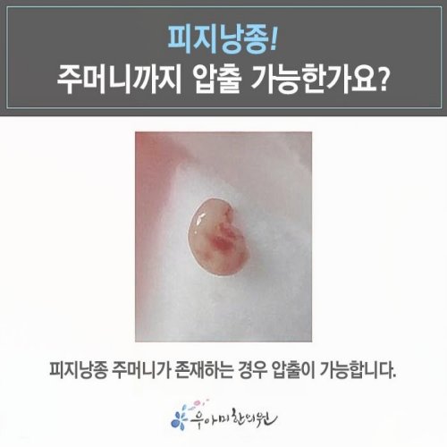 1787032675_ePKfpYzu.jpg