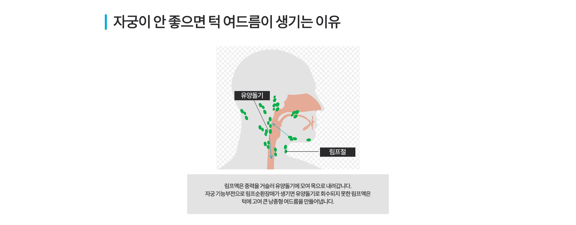 자궁질환 여드름
