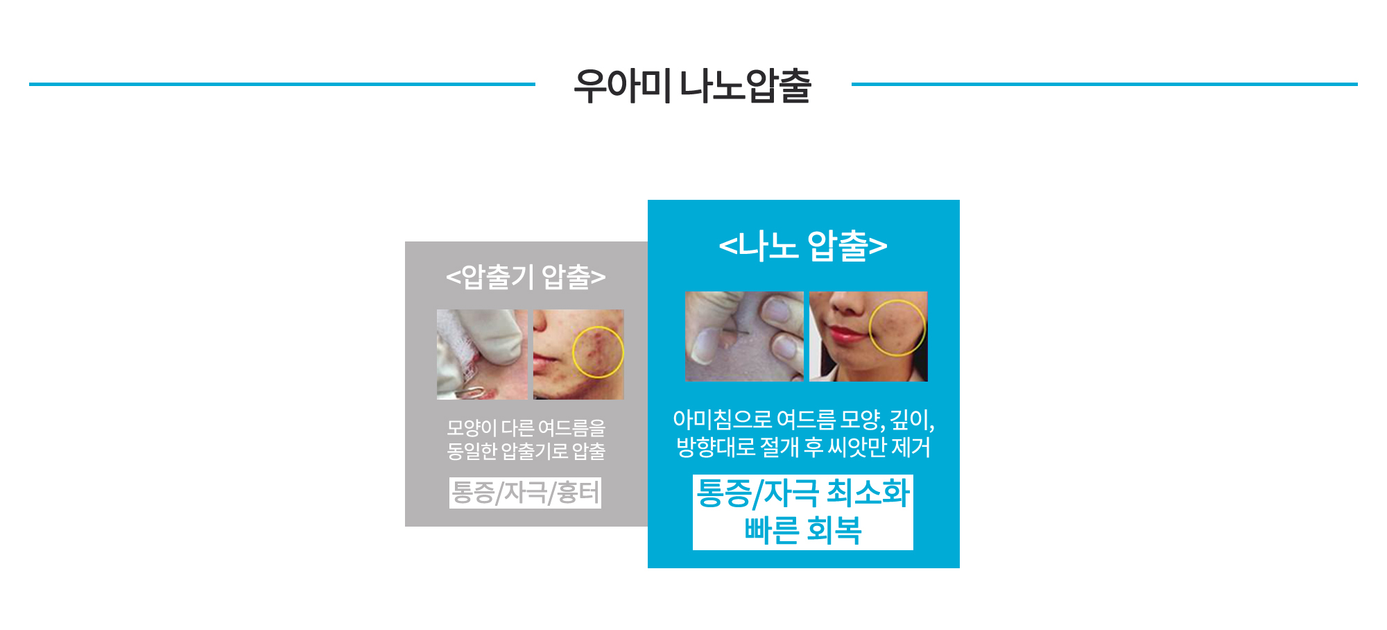 자궁질환 여드름