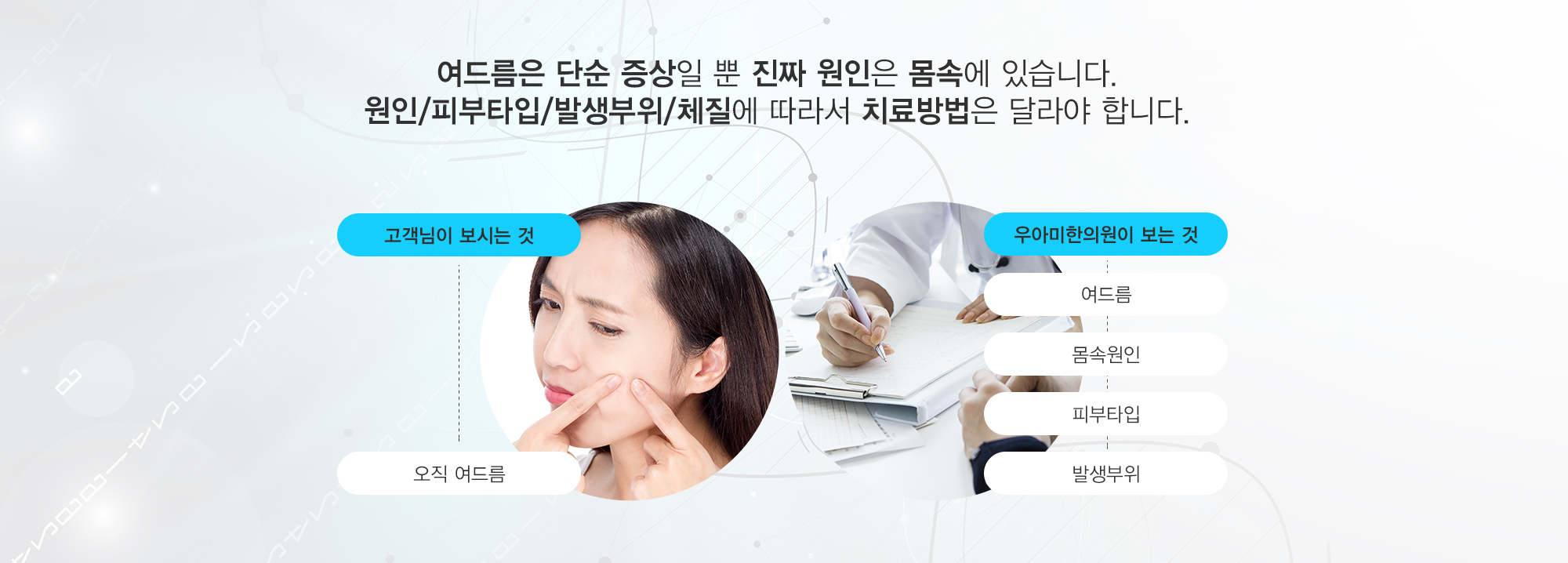 여드름이란?
