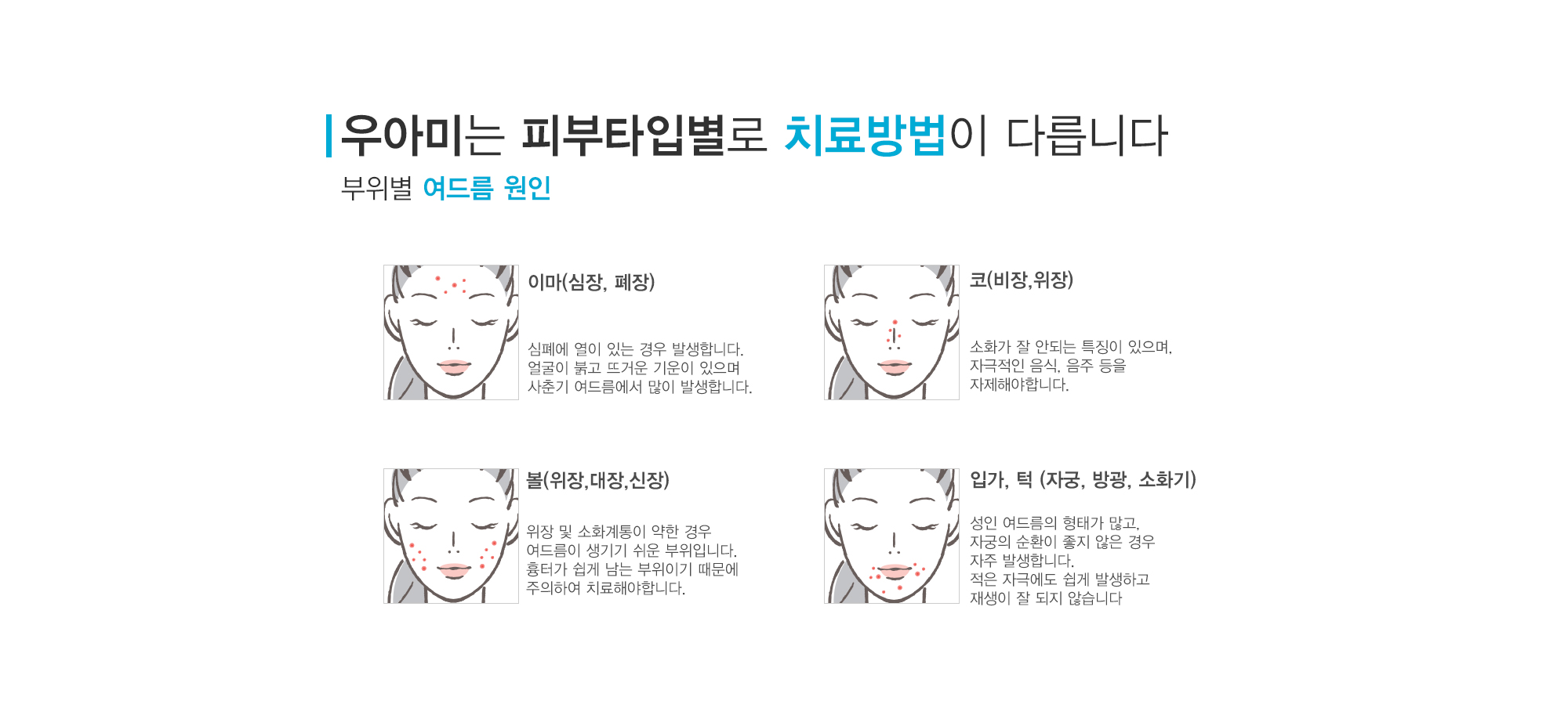 여드름이란?