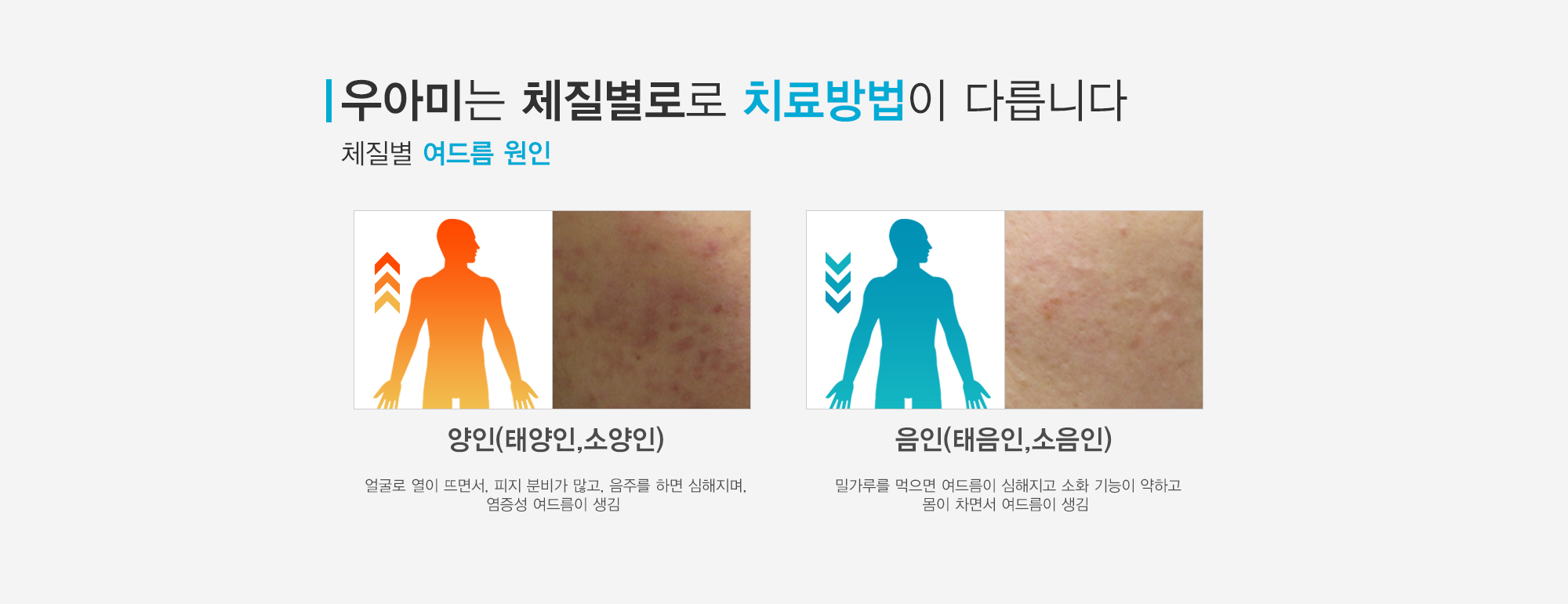 여드름이란?