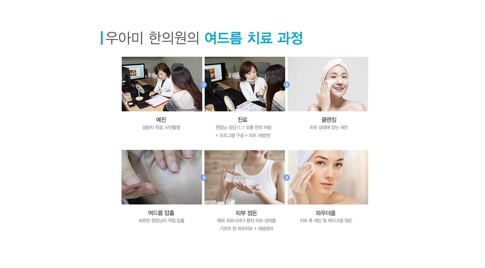 여드름이란?
