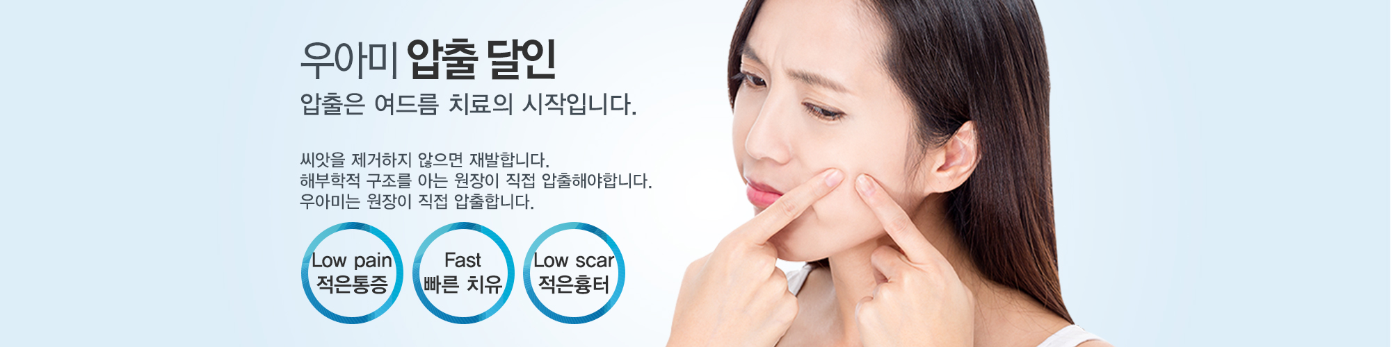 여드름이란?