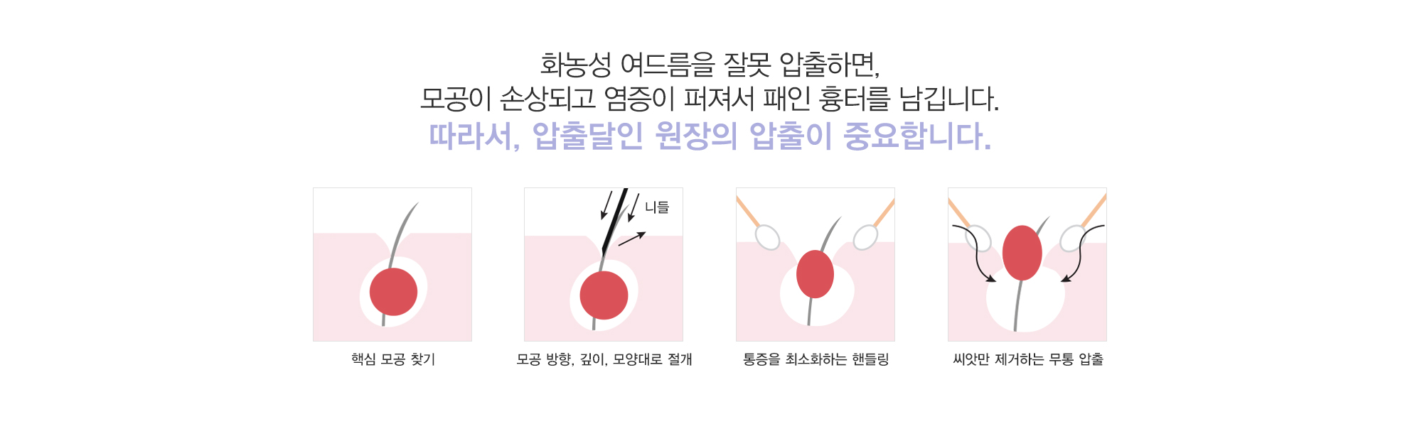 여드름이란?
