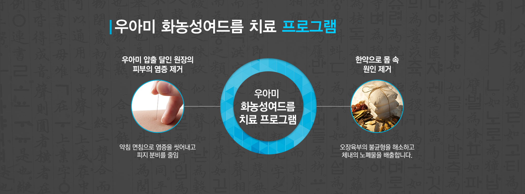 여드름이란?