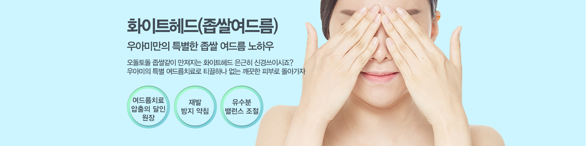 여드름이란?