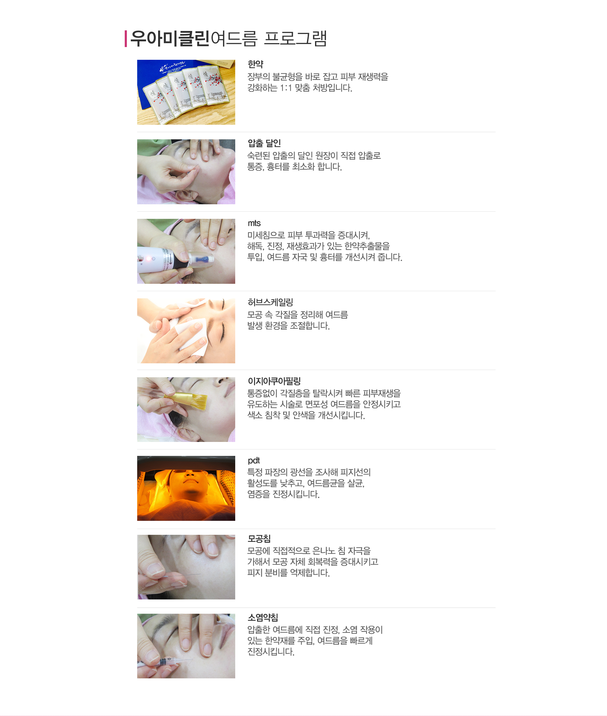 여드름이란?