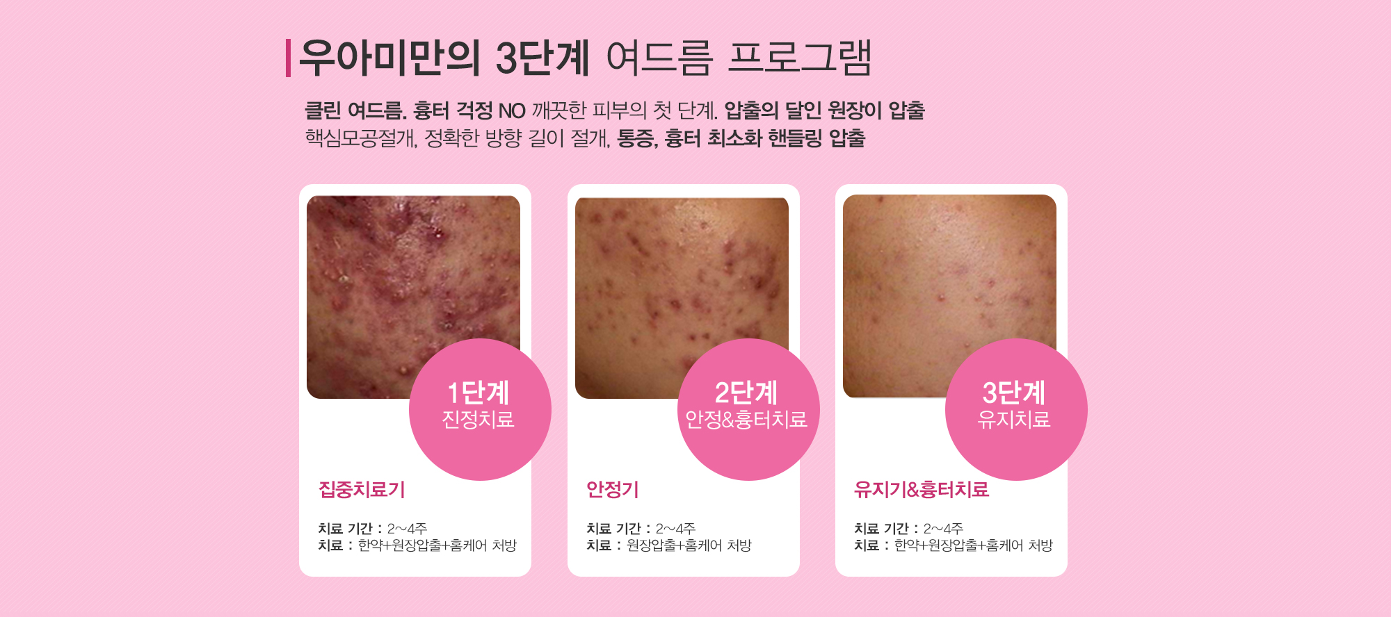 여드름이란?