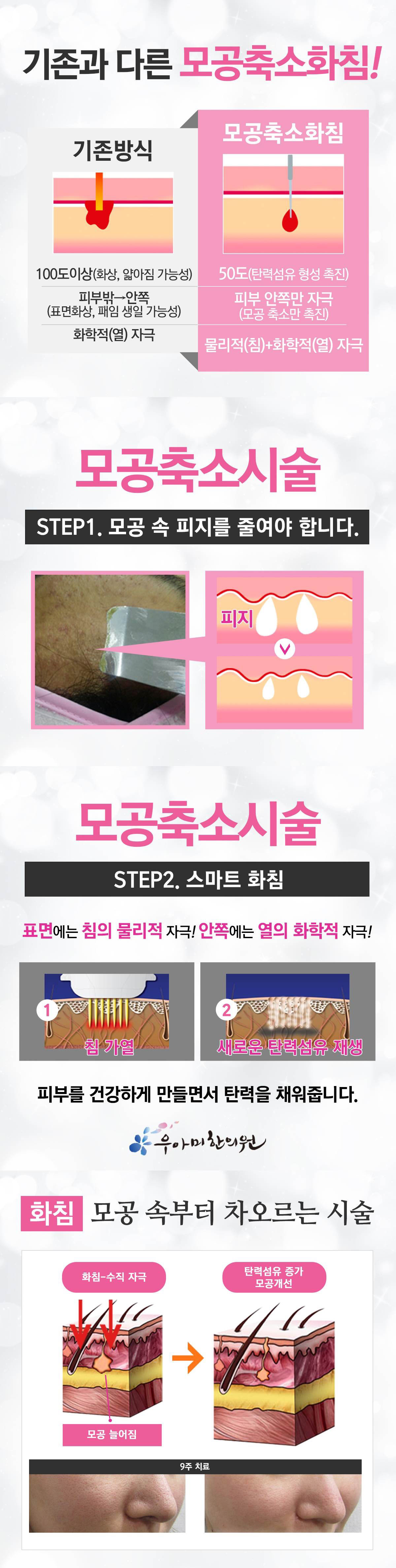 여드름이란?
