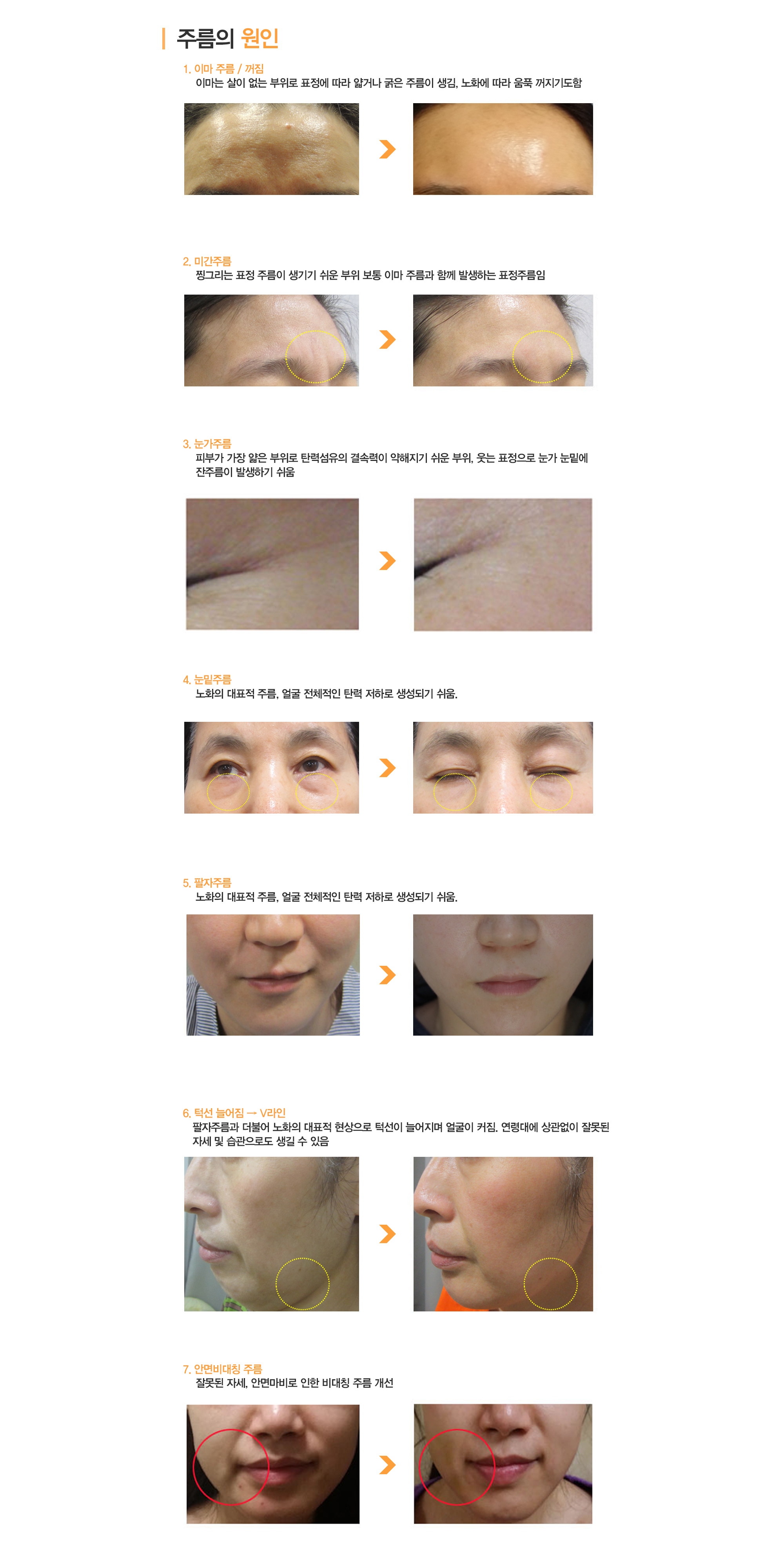 한방성형