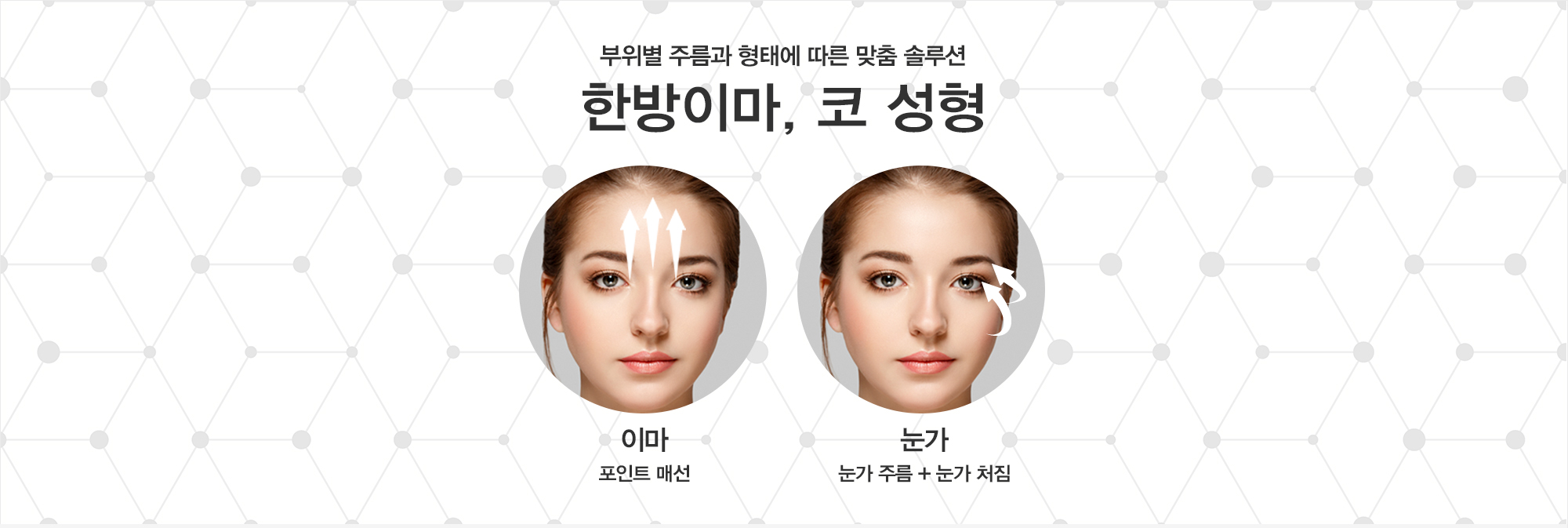 한방성형