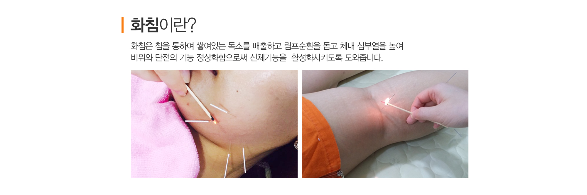 부종