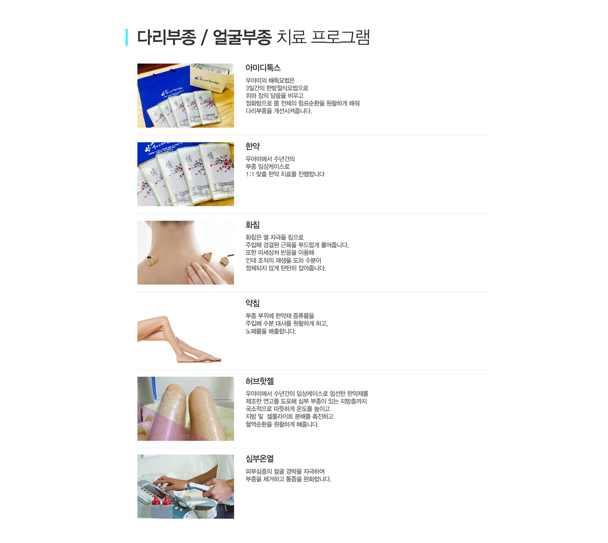 부종