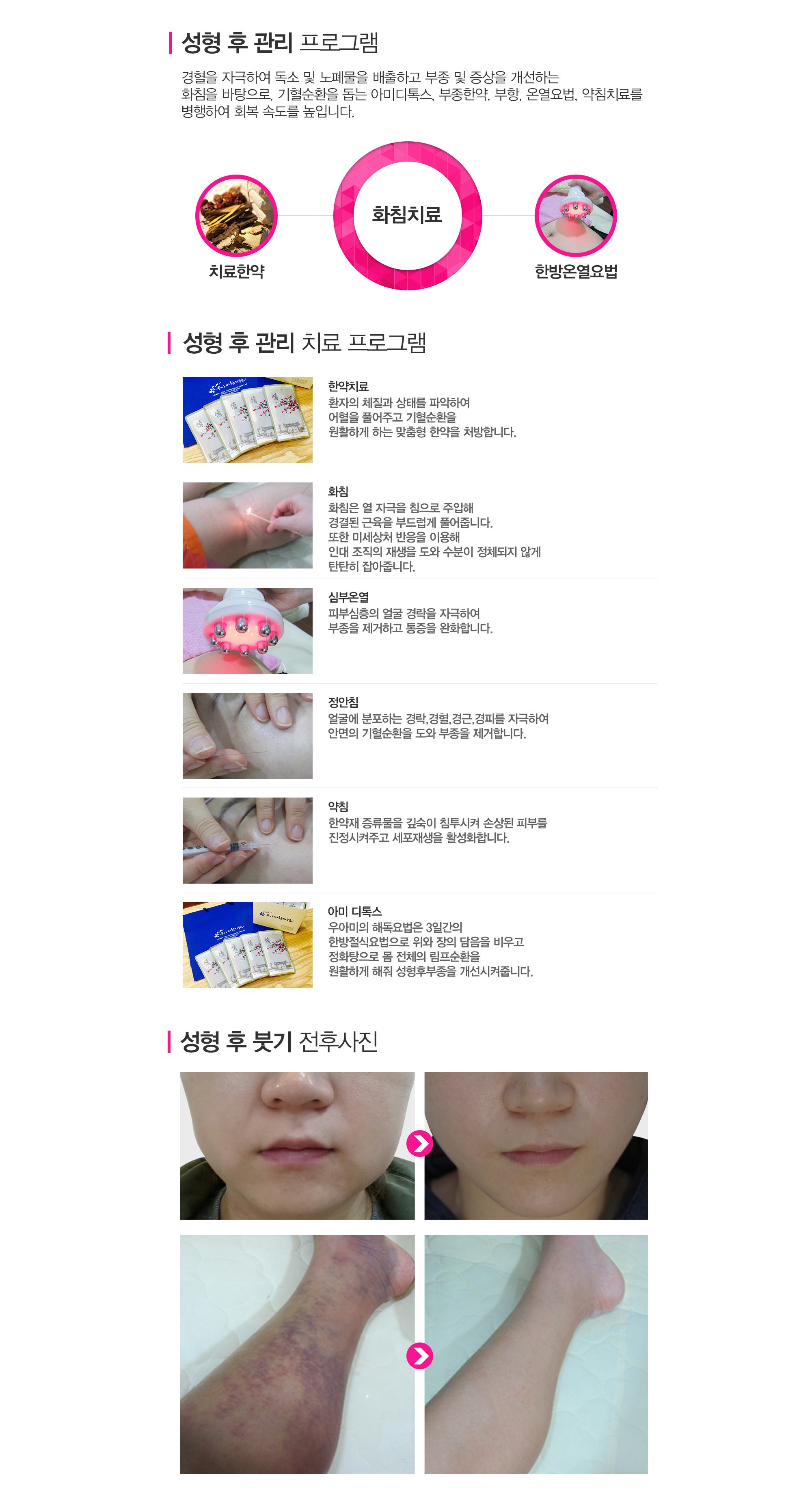 부종