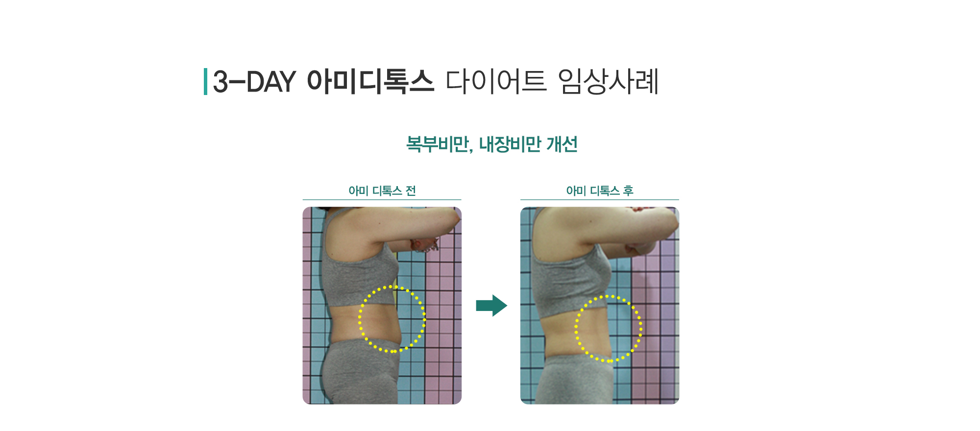 다이어트