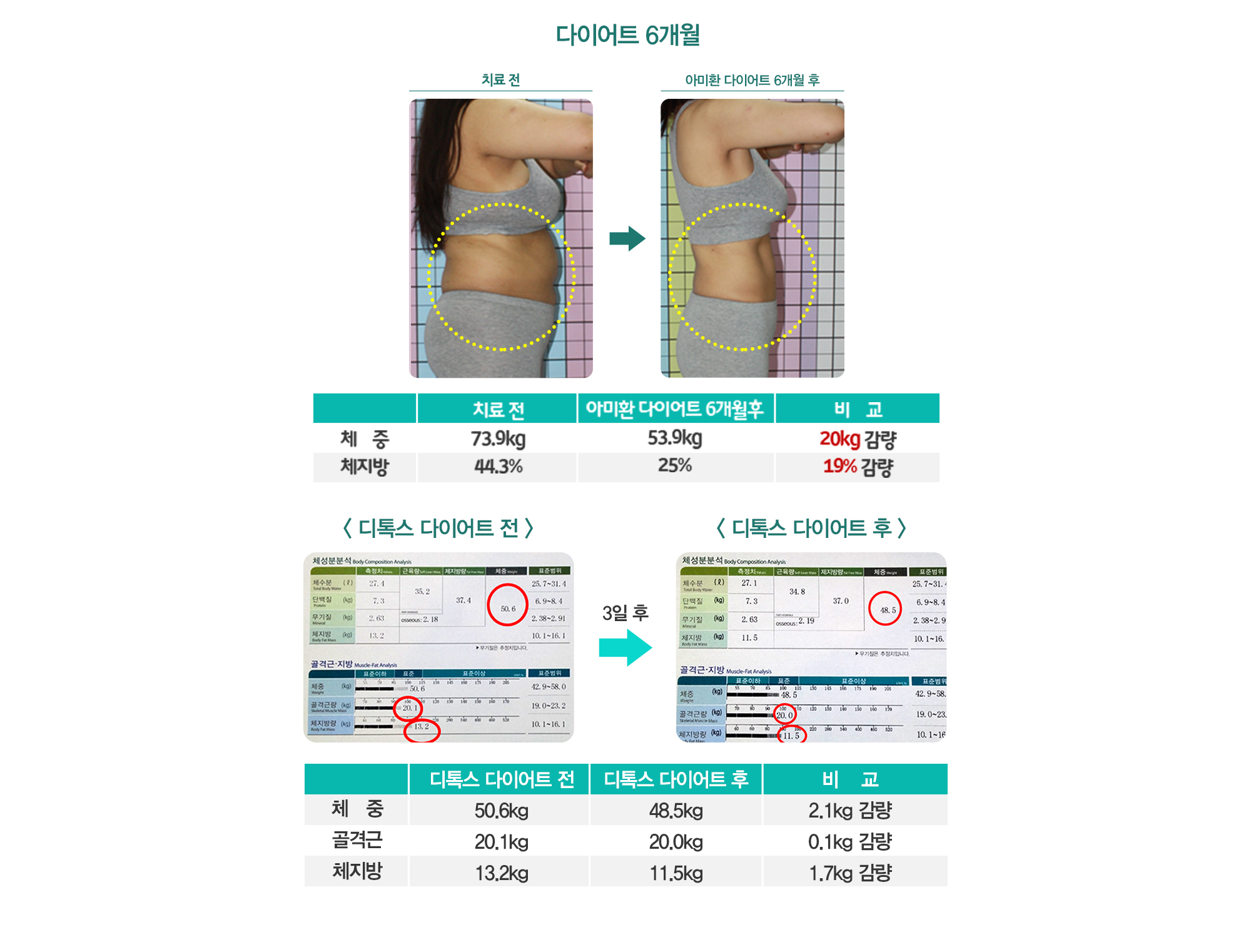 다이어트