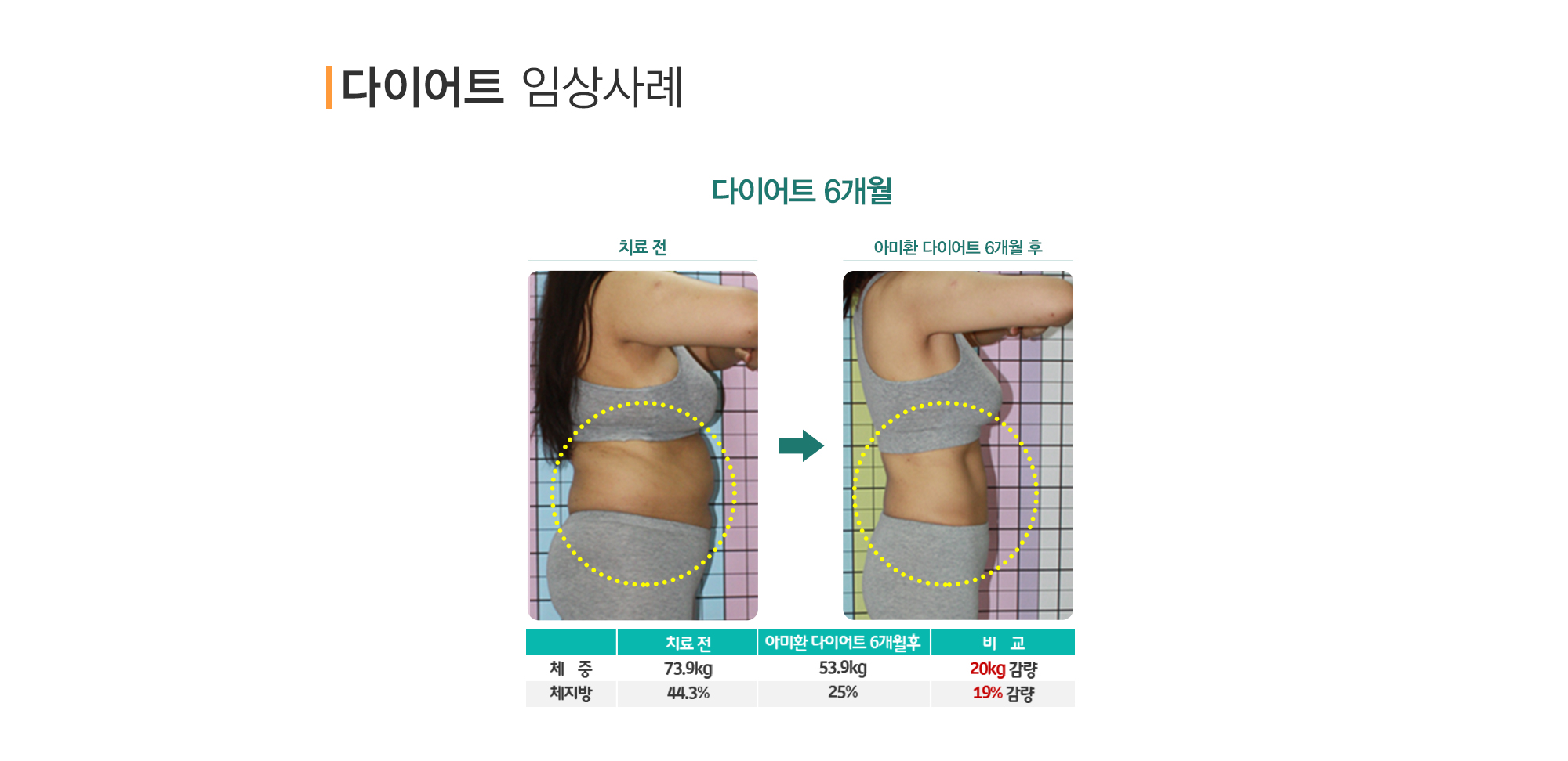 다이어트