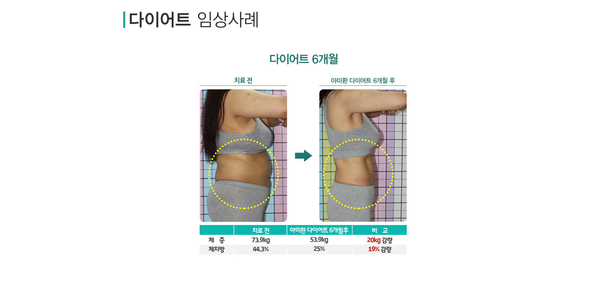 다이어트