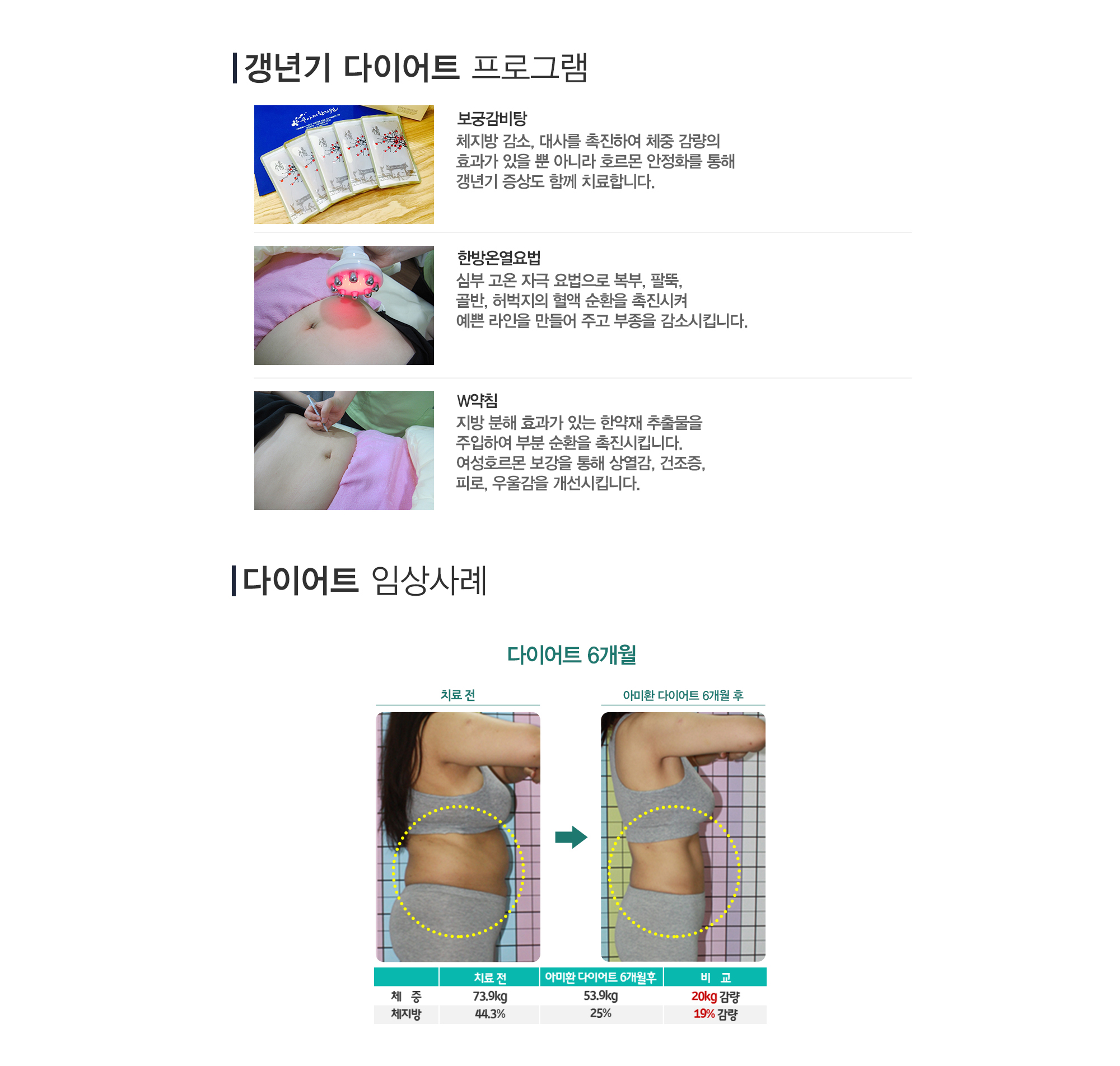 다이어트