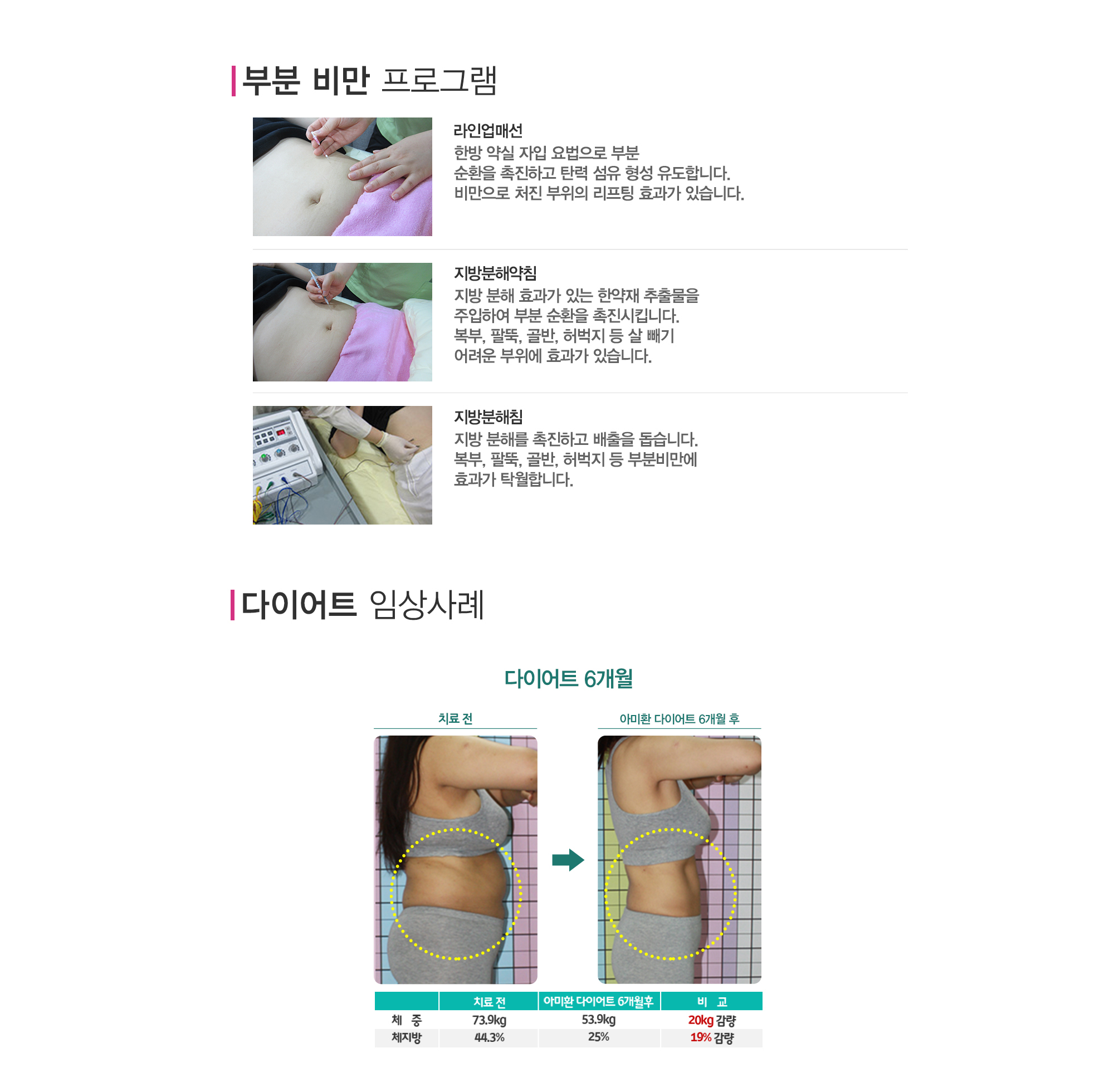 다이어트