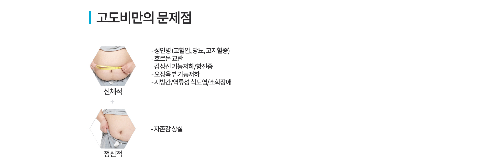 고도비만 다이어트