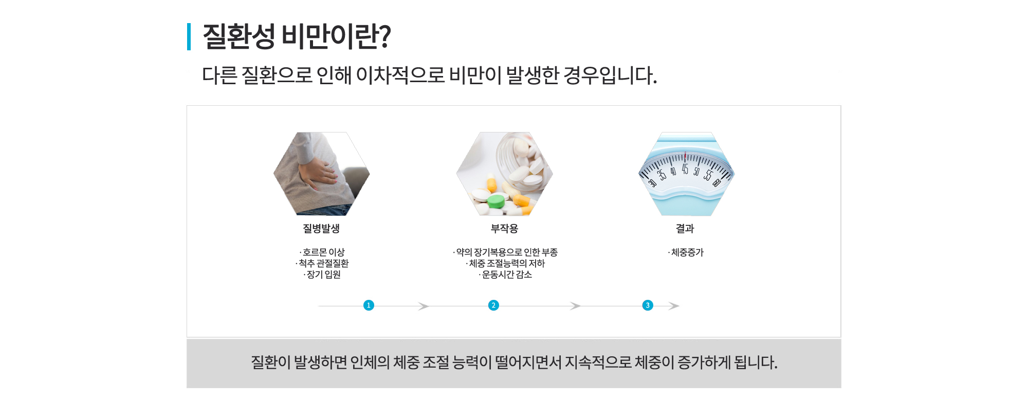 질환성 비만 다이어트