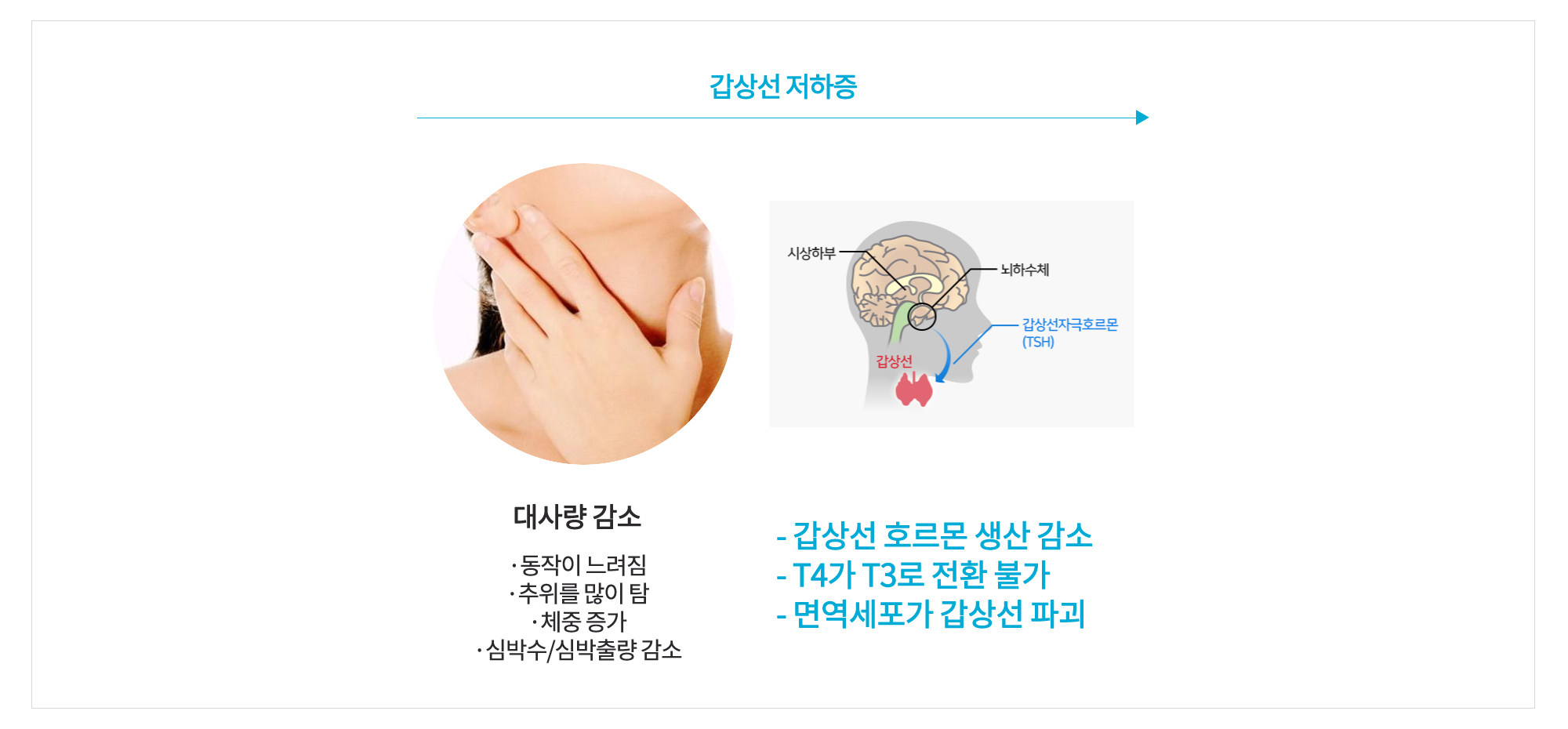 갑상선치료 다이어트