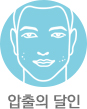 무통압출