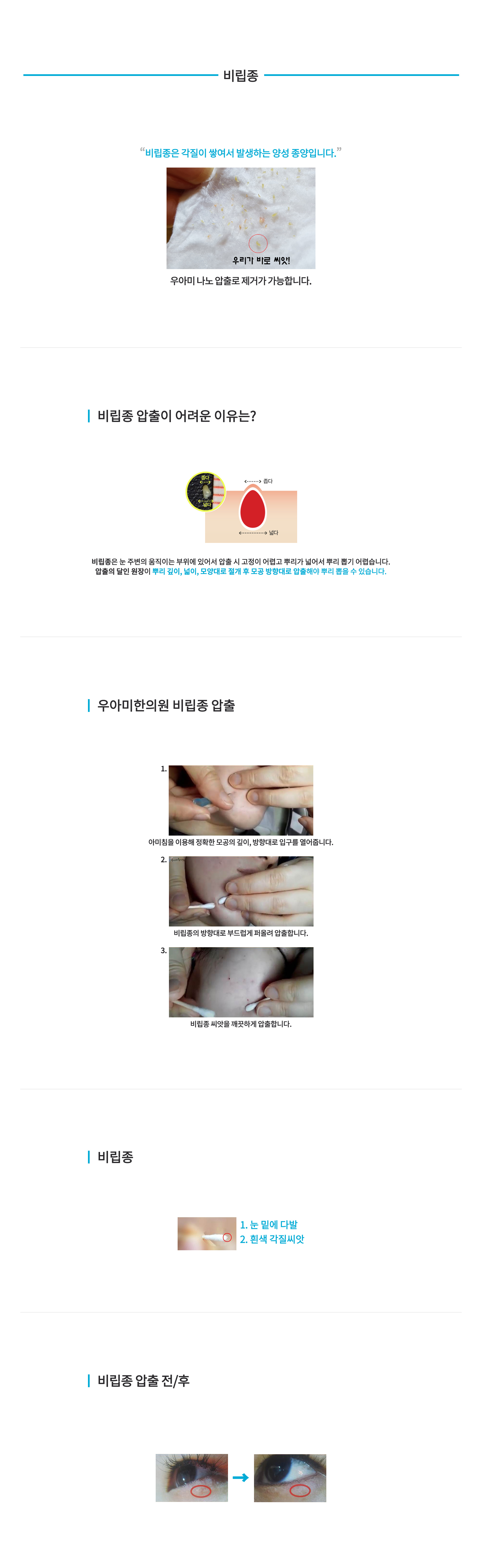 비립성