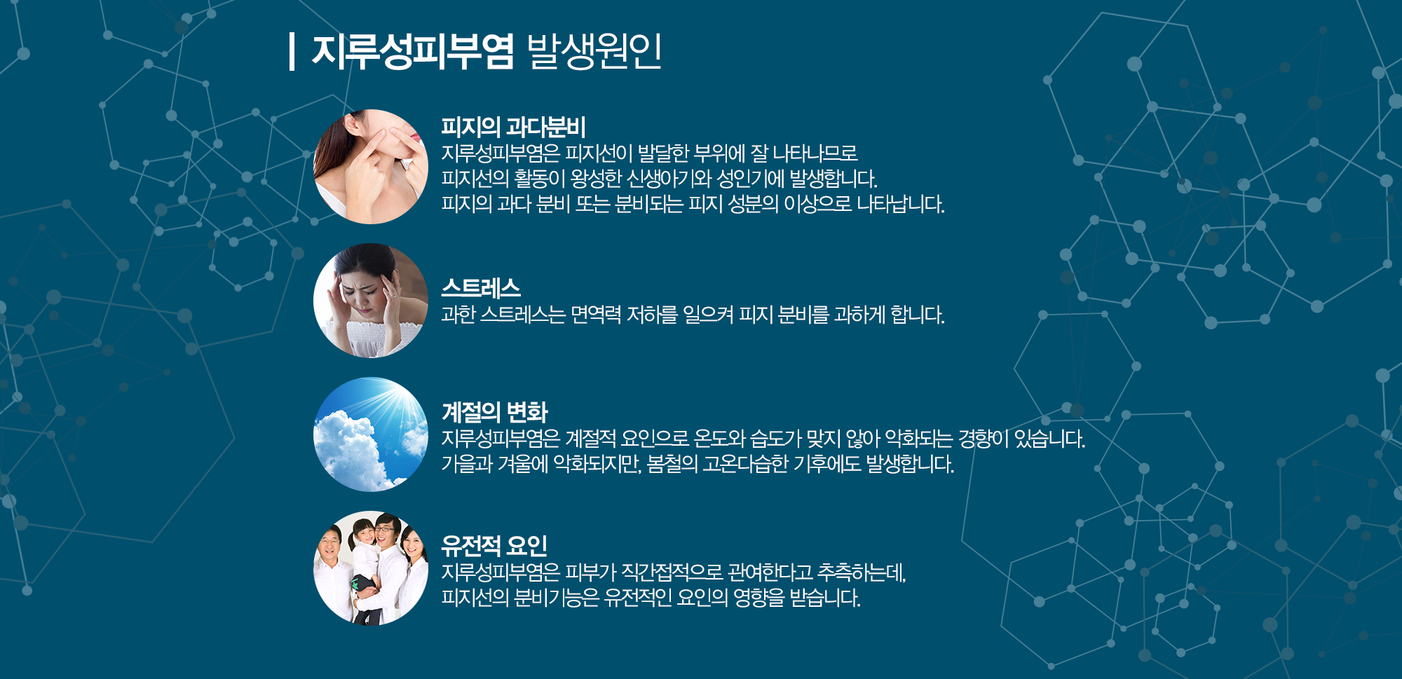 지루성