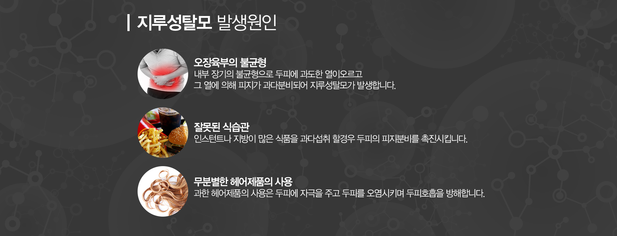 지루성