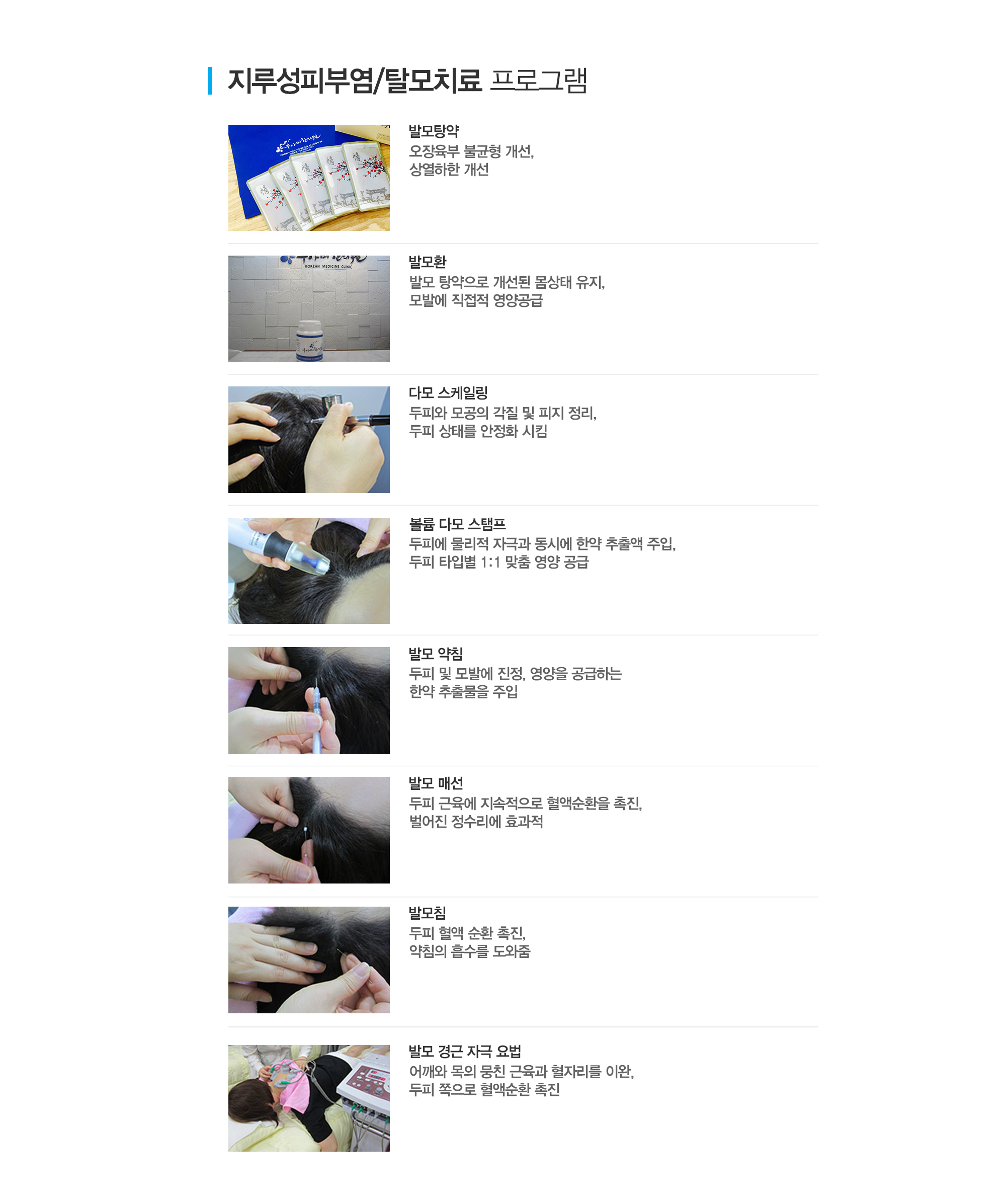 지루성