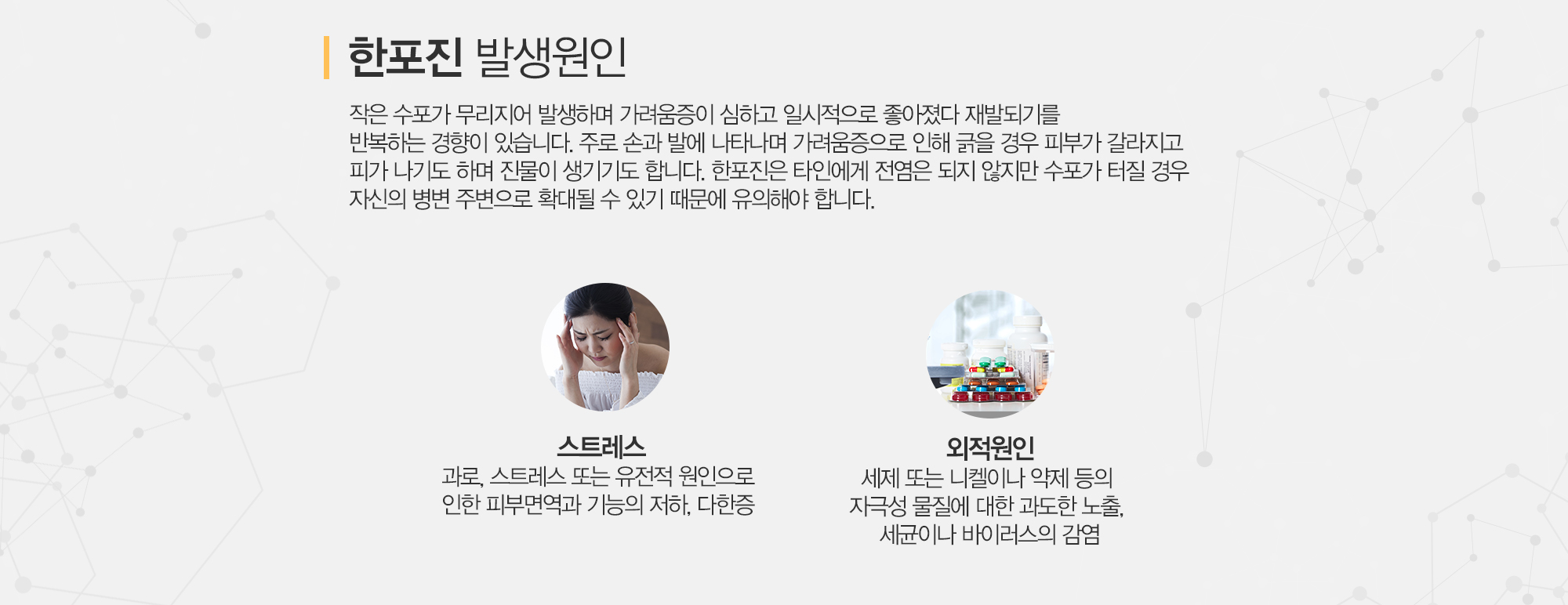 지루성