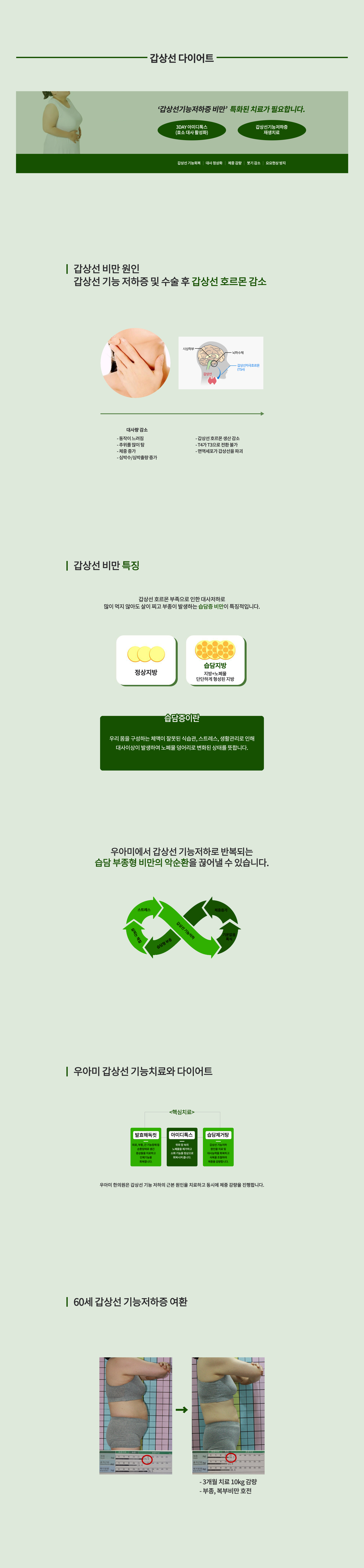 갑상선부종/다이어트