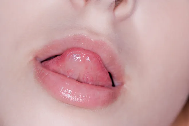 혀 아래 금진혈 · 옥액혈 부위를 보여주는 이미지