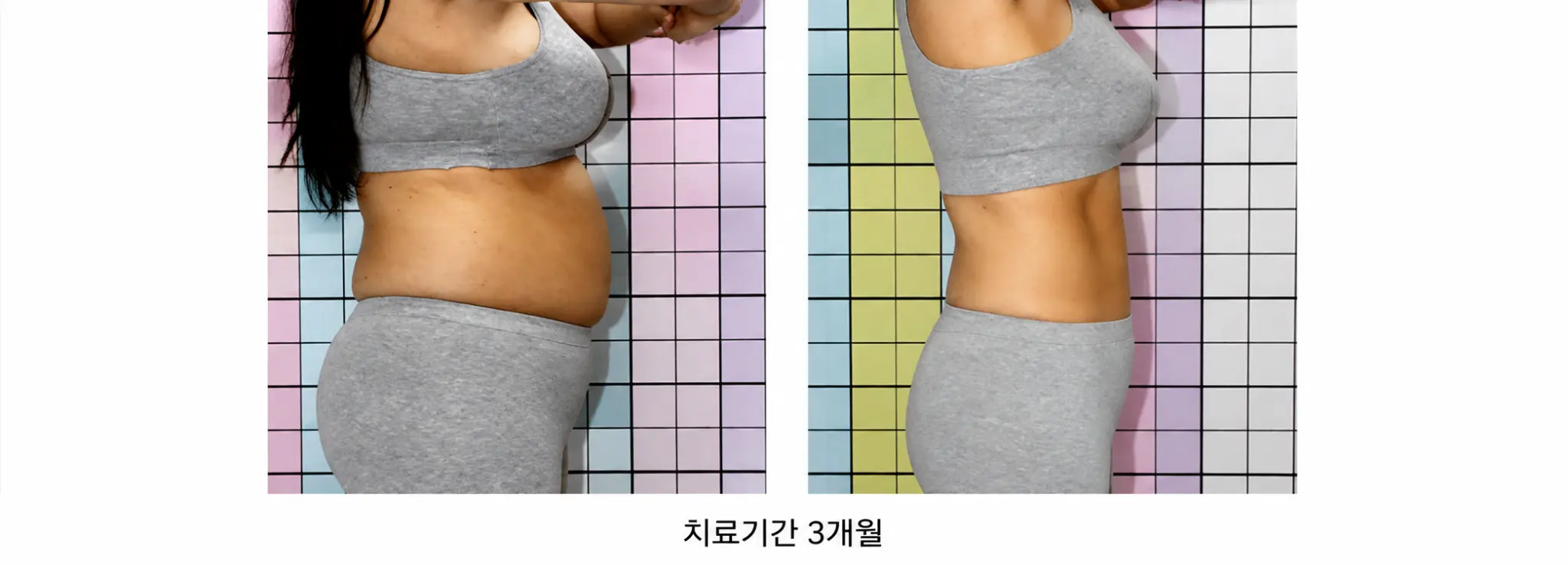 물만 마셔도 살이 찌고, 굶고 운동해도 안 빠진다면?
체지방보다 붓기가 먼저 늘어나는 몸 상태일 수도 있습니다.