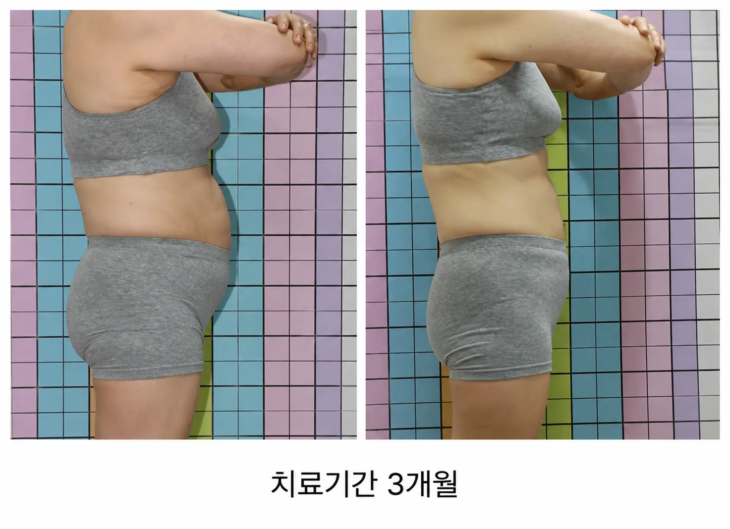 갱년기 체중증가,
아랫배부터 달라지는 시기입니다.