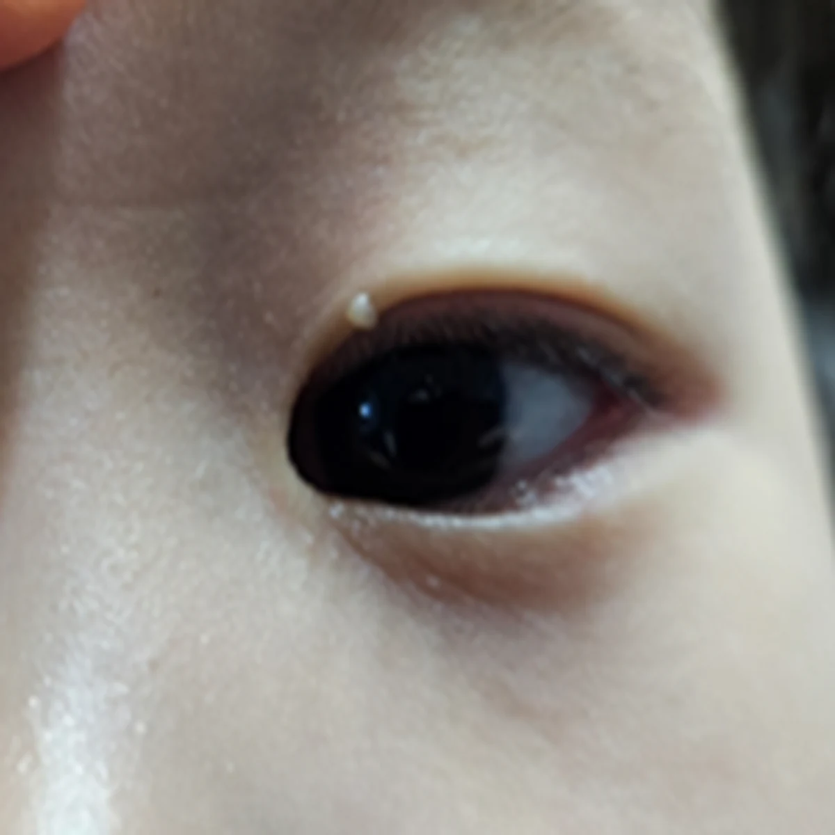임산부 · 소아 · 청소년도 치료 가능합니다.