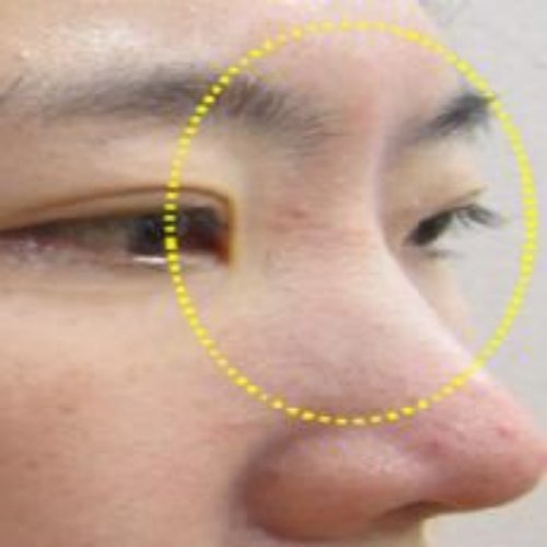 치료 후