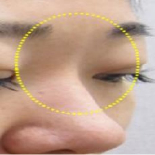 치료 후