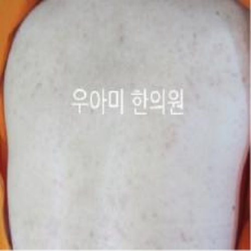 치료 후