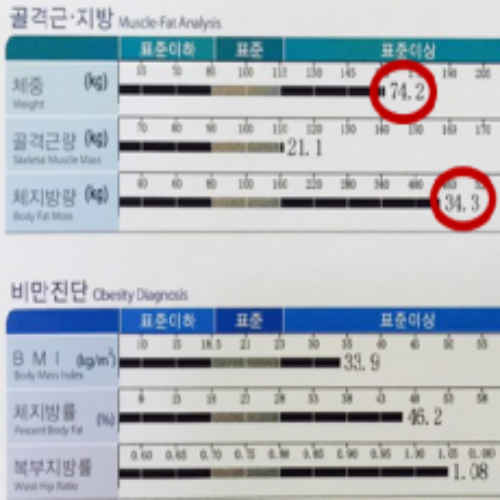 치료 전