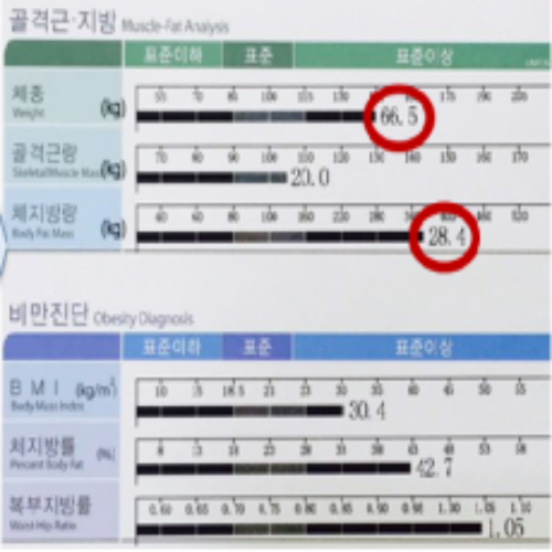 치료 후