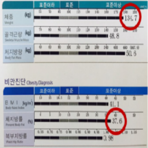 치료 전
