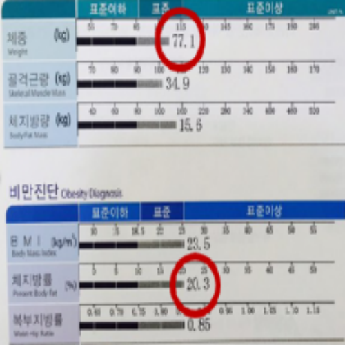 치료 후