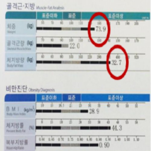 치료 전