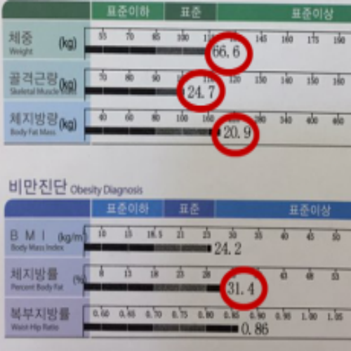 치료 전